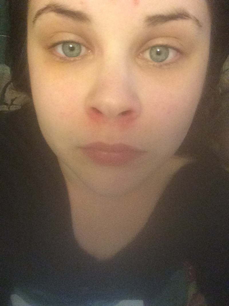 Illustration for article titled What the hell is going on with my skin? Diagnose me GT.